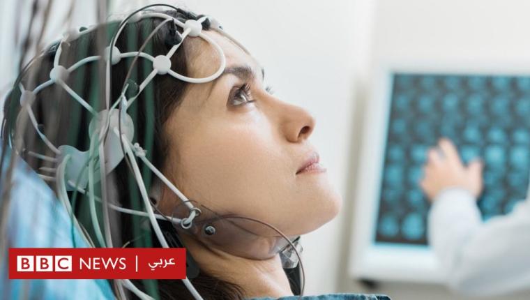 تجربة تكشف أن تحفيز الدماغ كهربائيا يقوي الذاكرة لمدة شهر