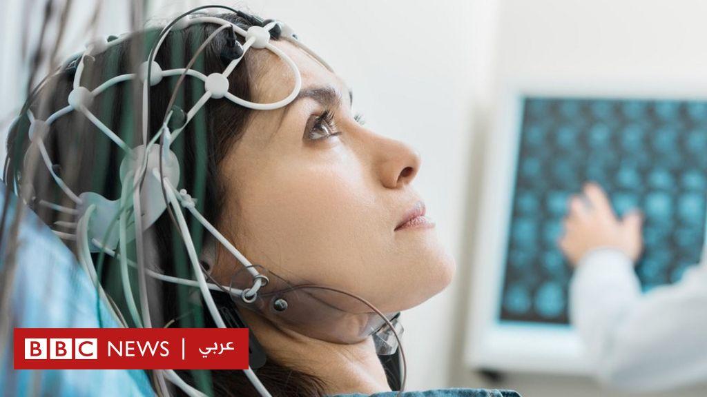 تجربة تكشف أن تحفيز الدماغ كهربائيا يقوي الذاكرة لمدة شهر