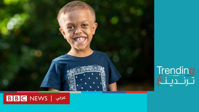 بعد تعرضه للتنمر .. طفل أسترالي مصاب بالتقزم يحصل على أدوار سينمائية