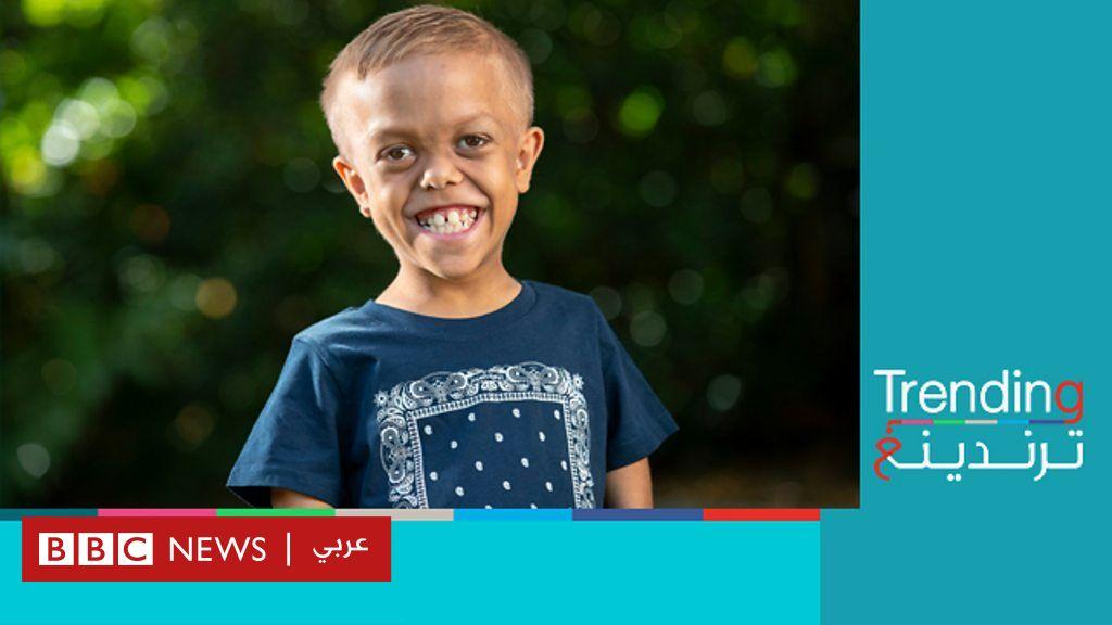 بعد تعرضه للتنمر .. طفل أسترالي مصاب بالتقزم يحصل على أدوار سينمائية