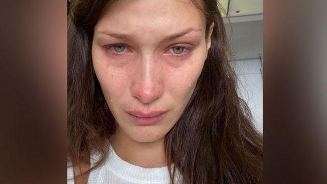 بيلا حديد باكية على انستغرام: "وسائل التواصل الاجتماعي ليست حقيقية".